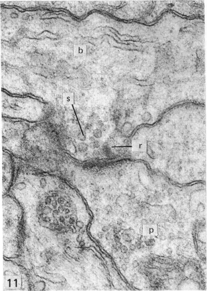 Fig. 11