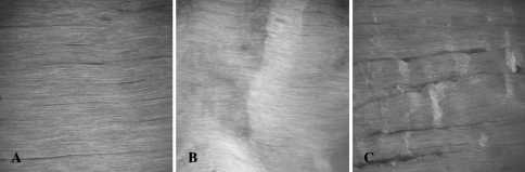 Fig. 1A–C