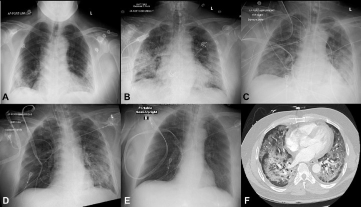 Fig. 12