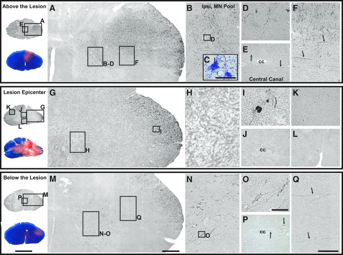 FIG. 12.