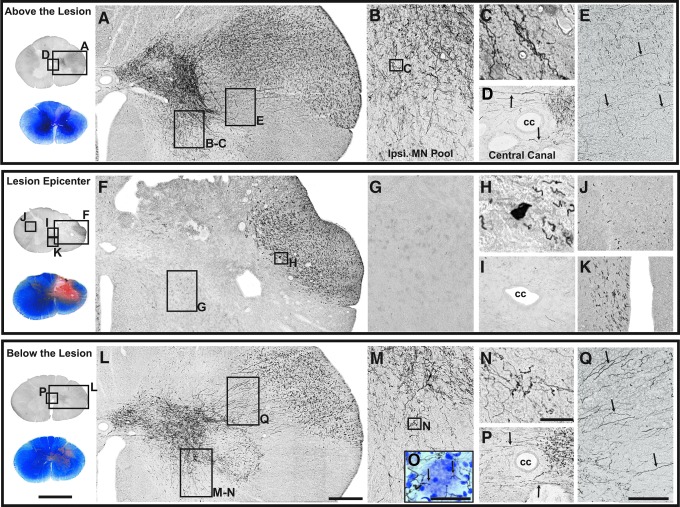 FIG. 11.