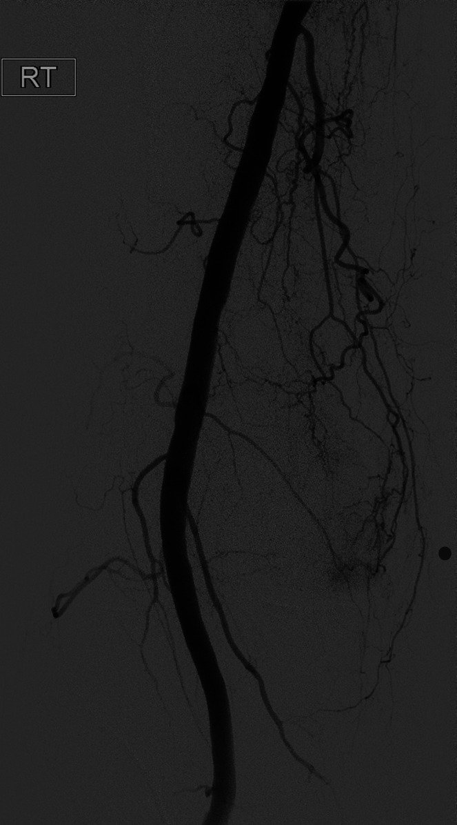 Fig. 2-C