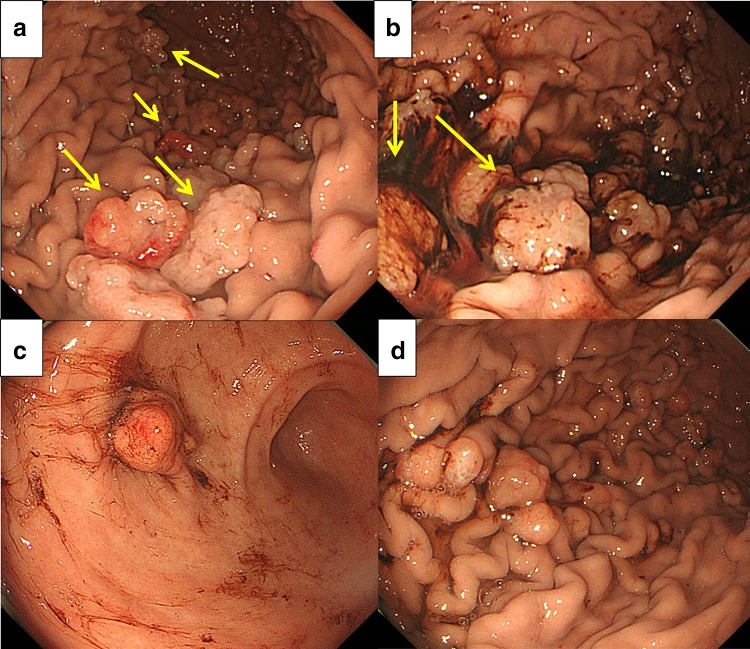 Fig. 1