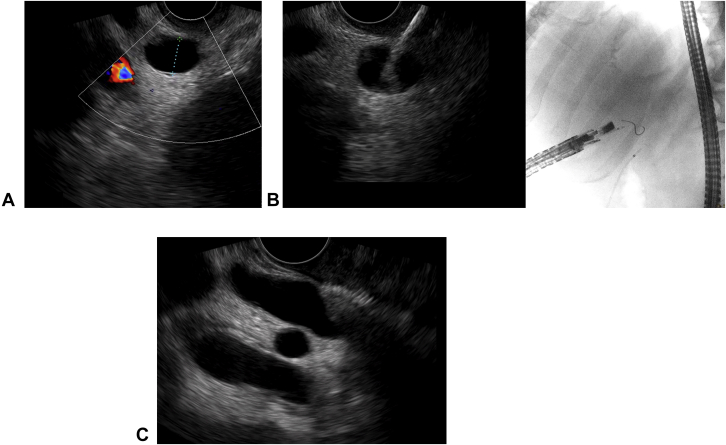 Figure 1