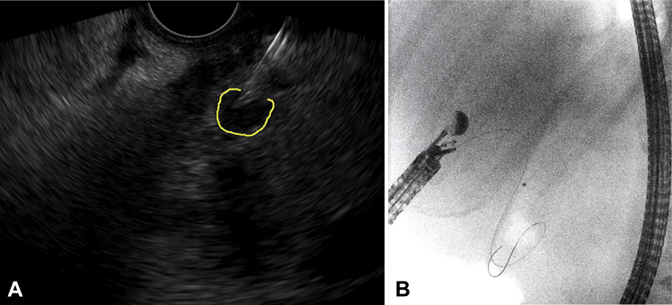 Figure 3