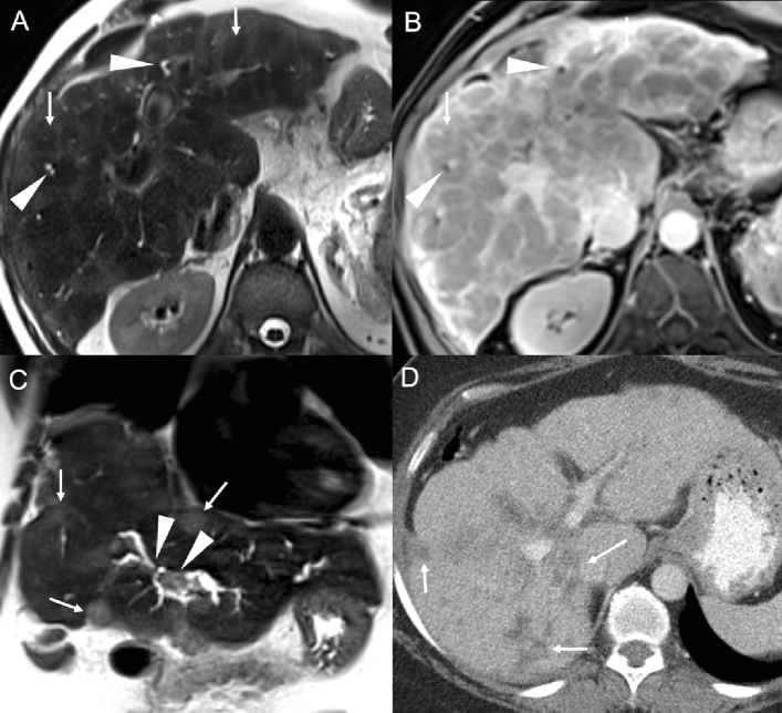 Fig. 15