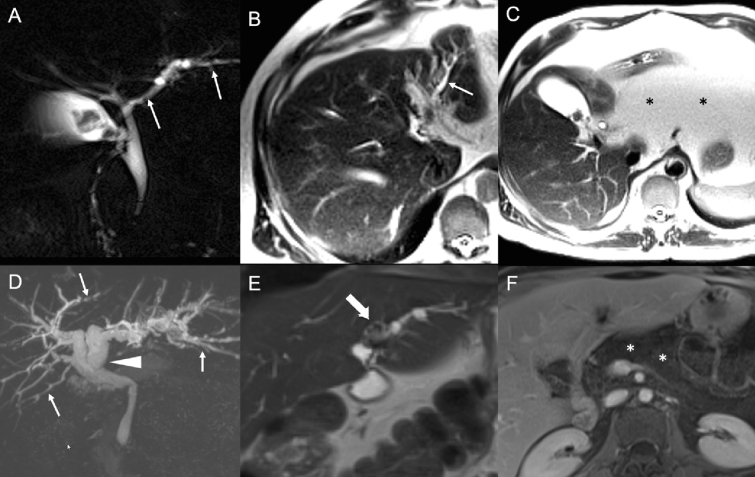 Fig. 13