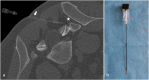 Fig. 9