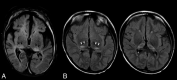 Fig 4.