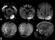 Fig 5.