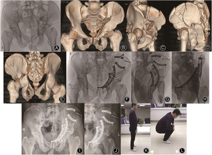 Fig. 2