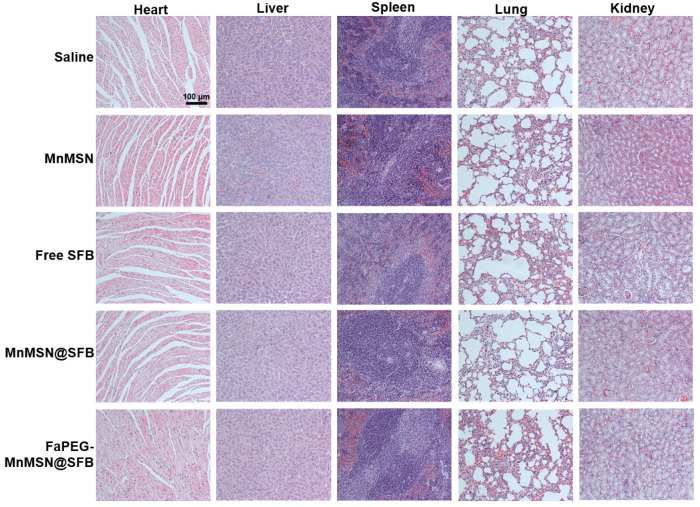 Figure 12