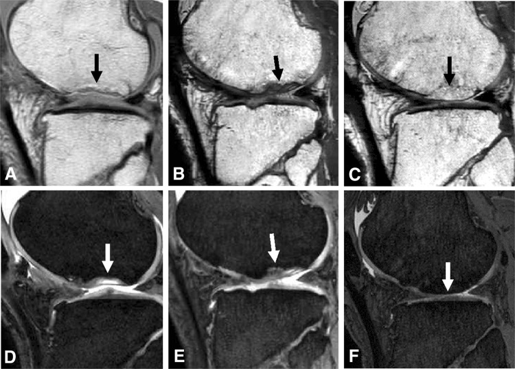 Fig. 4A–F