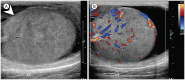 Fig. 12