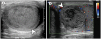 Fig. 11