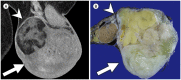 Fig. 16