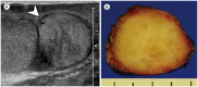 Fig. 13