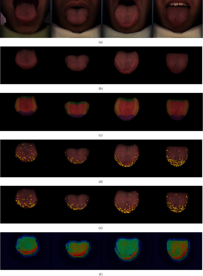 Figure 11