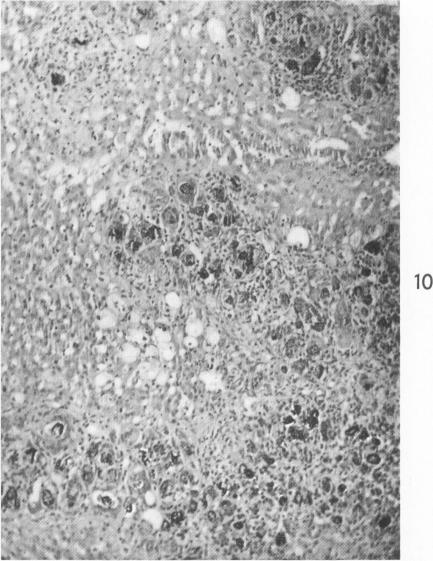 Fig. 10