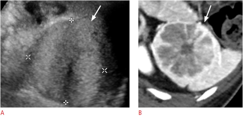 Fig. 13.