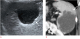 Fig. 10.