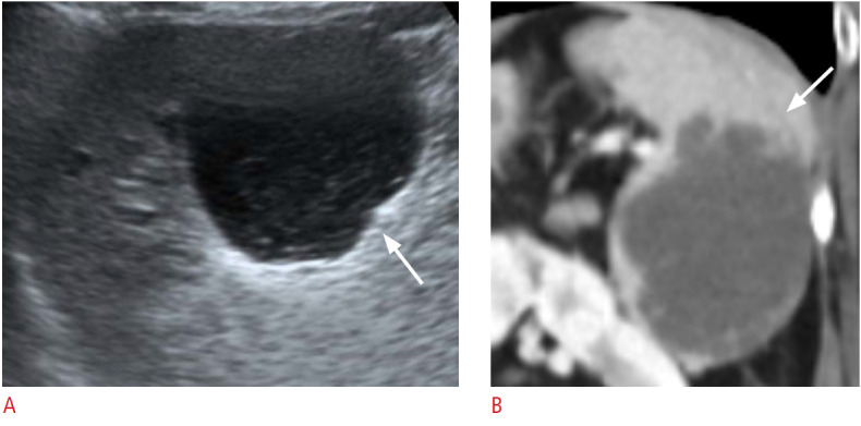 Fig. 10.