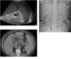 Fig. 17.