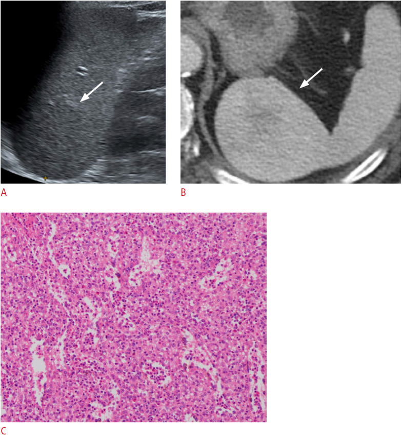 Fig. 11.