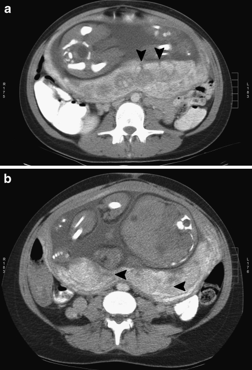 Fig. 4