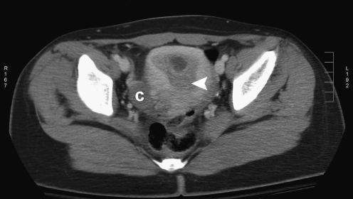 Fig. 2