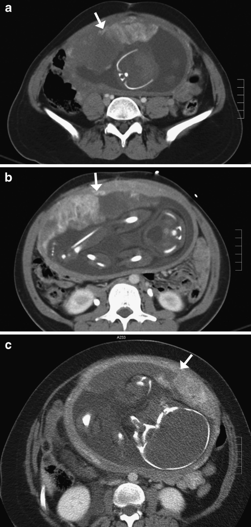 Fig. 6