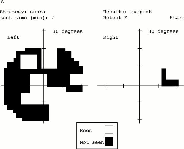 Figure 4  