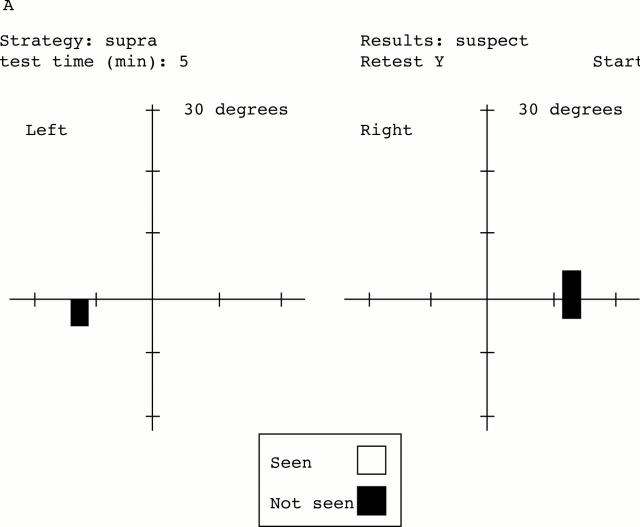 Figure 3  