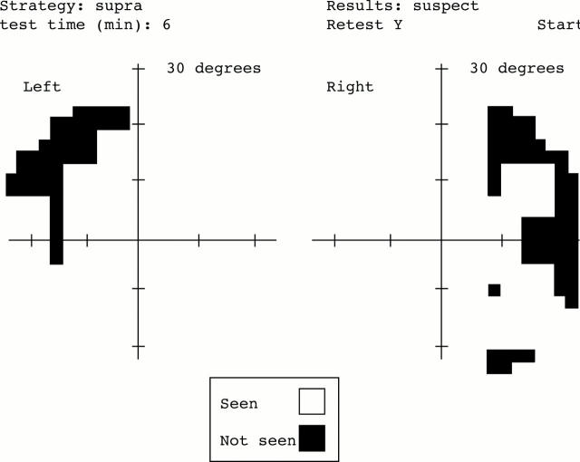 Figure 2  