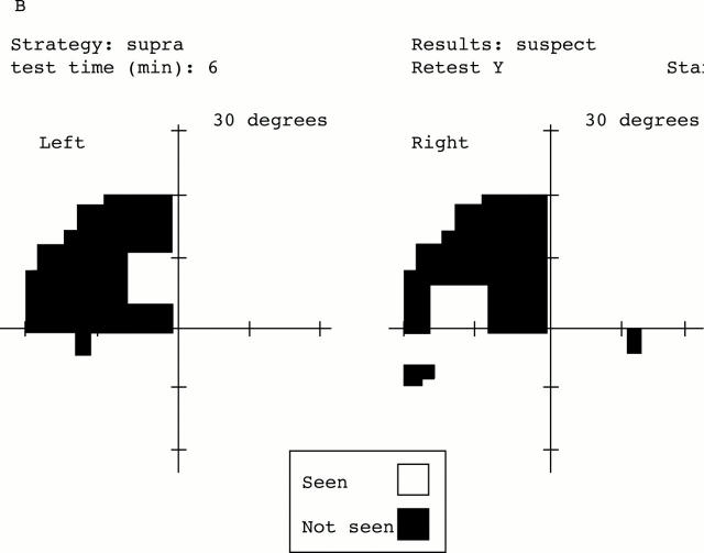 Figure 3  