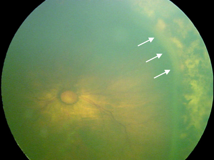 FIGURE 1C