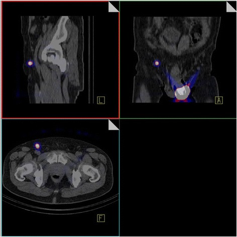 Fig. 1