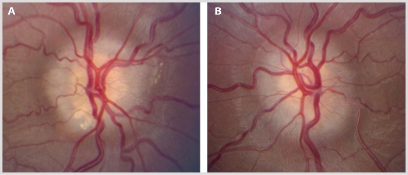 Figure 4-12.