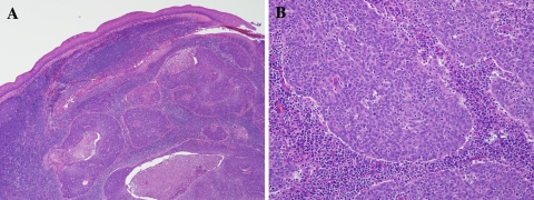 Fig. 1