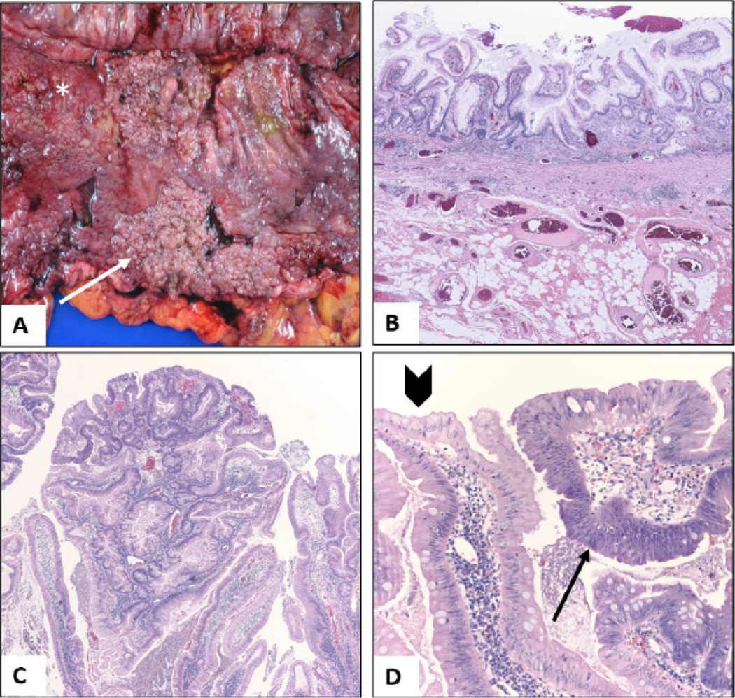 Figure 2: