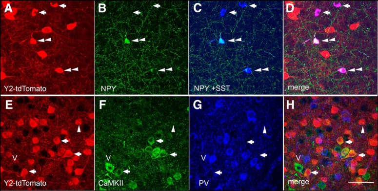 Figure 14.