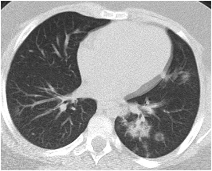 Fig. 3e