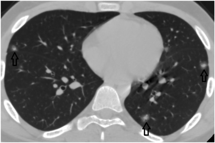 Fig. 3f