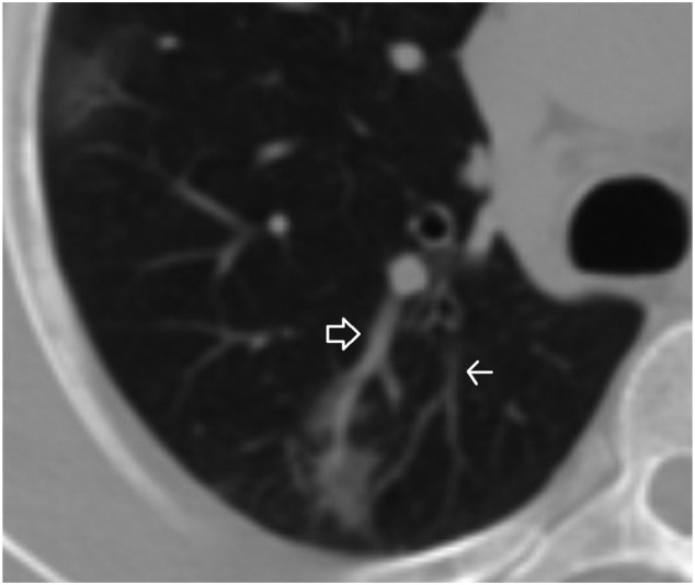 Fig. 1b