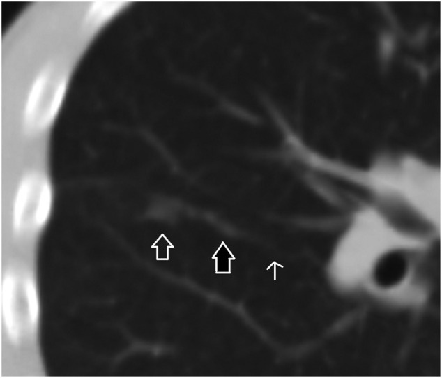 Fig. 1a