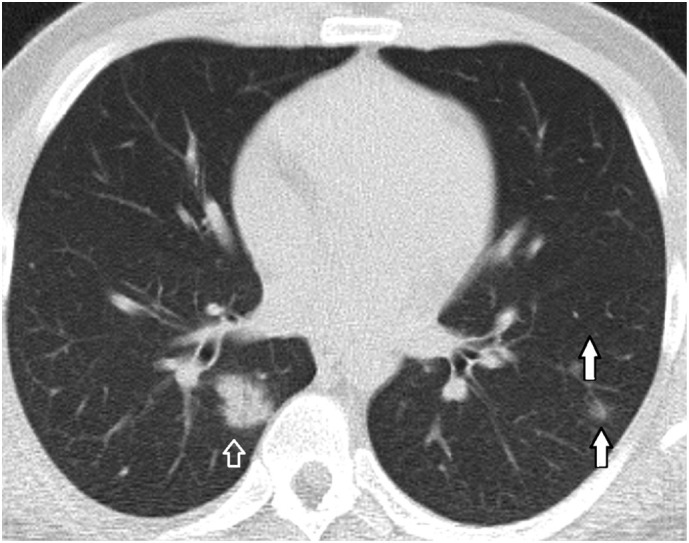 Fig. 2c