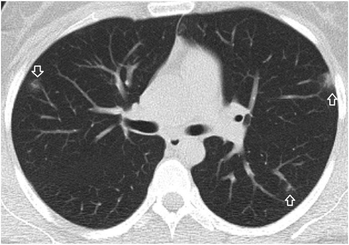 Fig. 2b