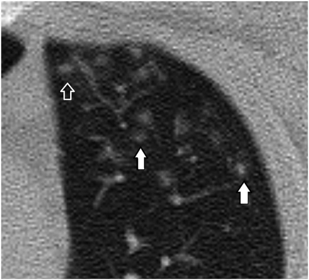 Fig. 1c