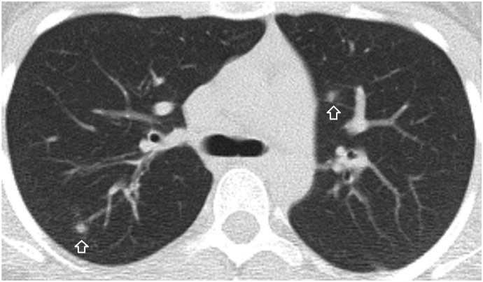 Fig. 2a