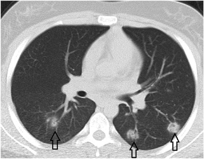 Fig. 3c